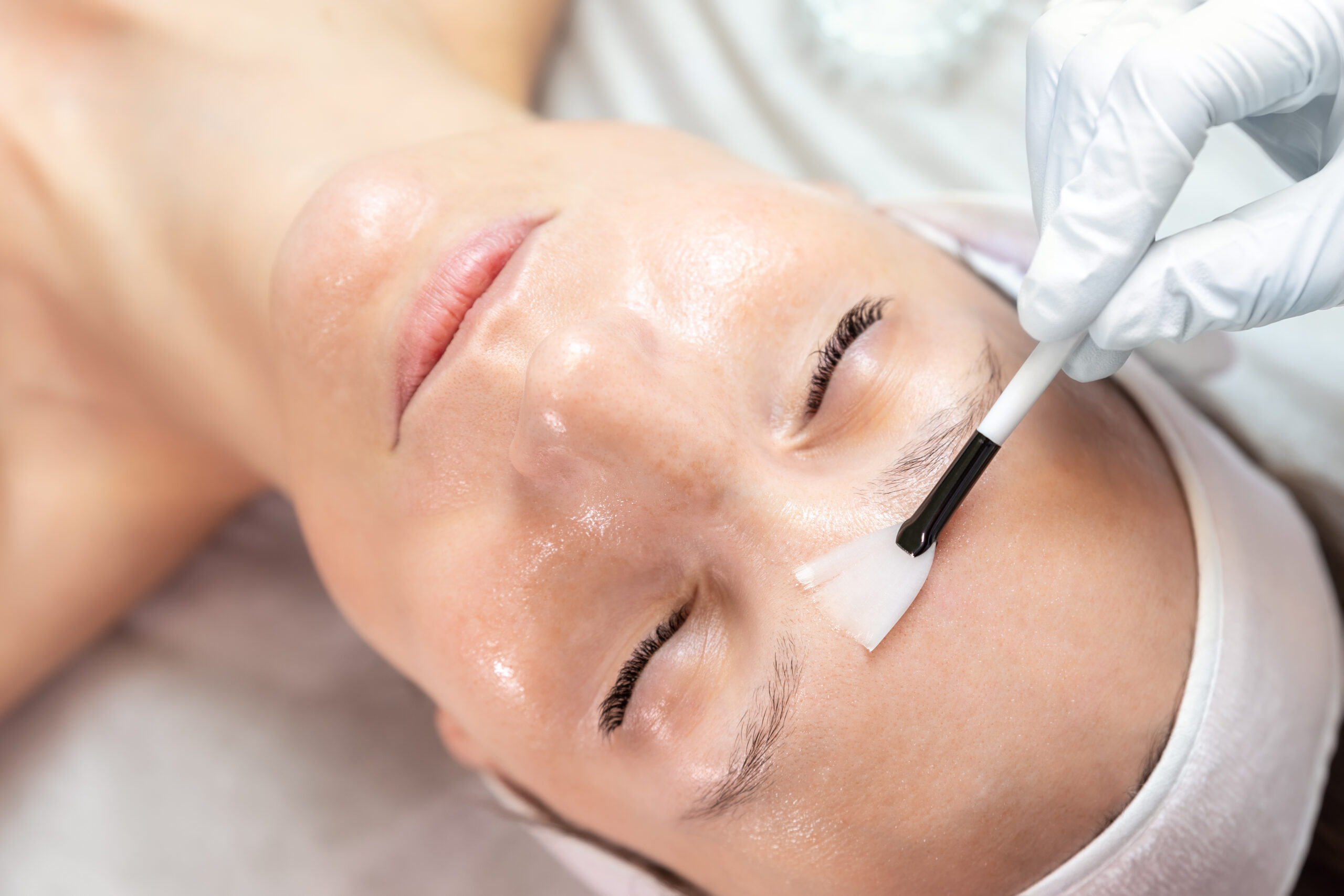 Experience the Ultimate Facial: Why the HydraFacial is a Game Changer